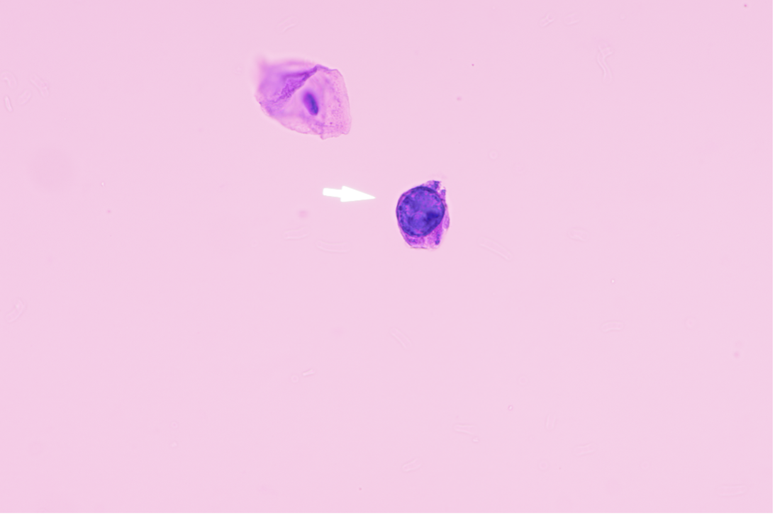 Case 1-4
